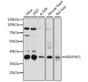 Western Blot - Anti-NDUFAF1 Antibody (A89629) - Antibodies.com