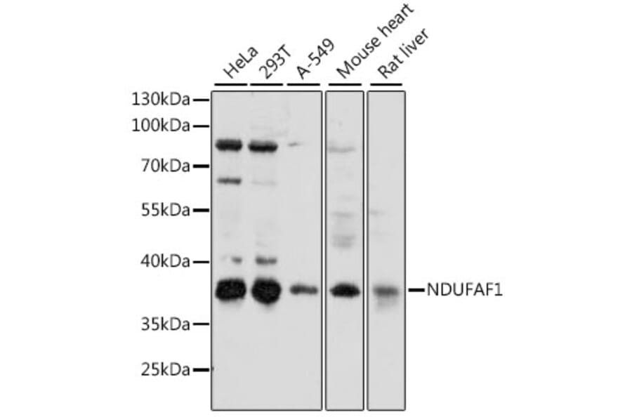 Western Blot - Anti-NDUFAF1 Antibody (A89629) - Antibodies.com