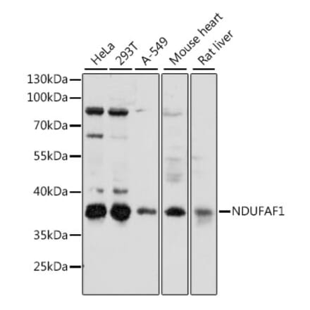 Western Blot - Anti-NDUFAF1 Antibody (A89629) - Antibodies.com