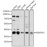 Western Blot - Anti-NDUFAF1 Antibody (A89629) - Antibodies.com