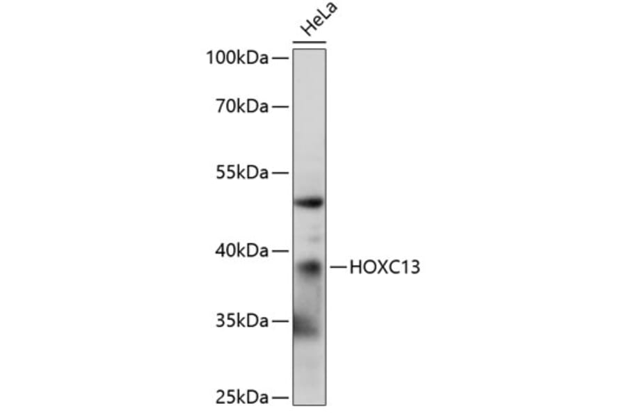 Western Blot - Anti-HOXC13 Antibody (A89630) - Antibodies.com