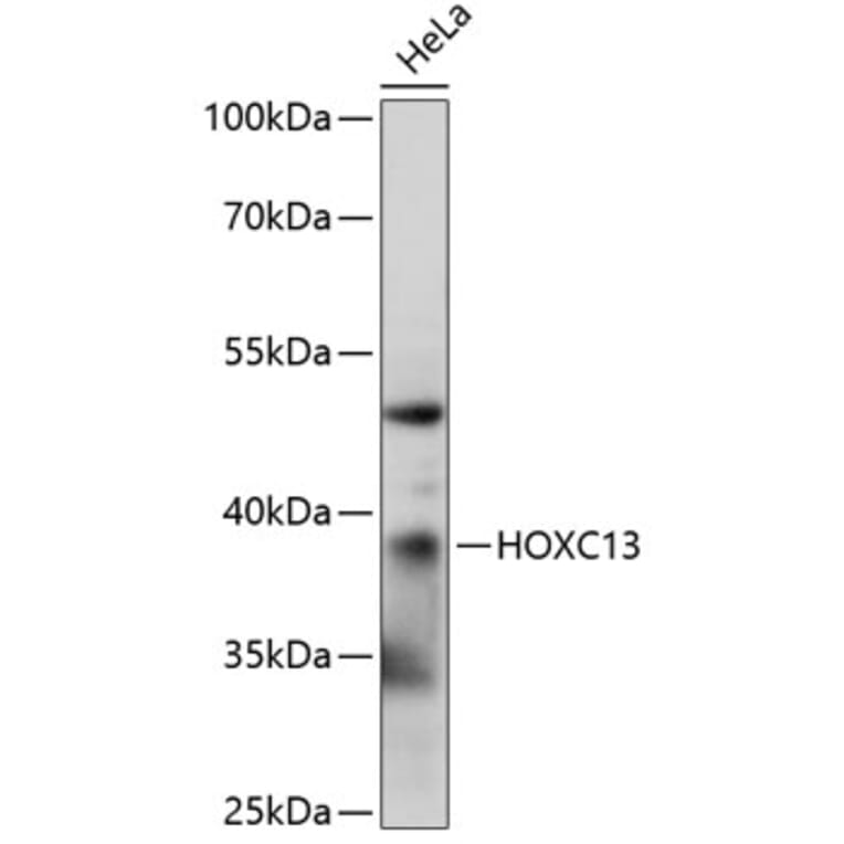 Western Blot - Anti-HOXC13 Antibody (A89630) - Antibodies.com
