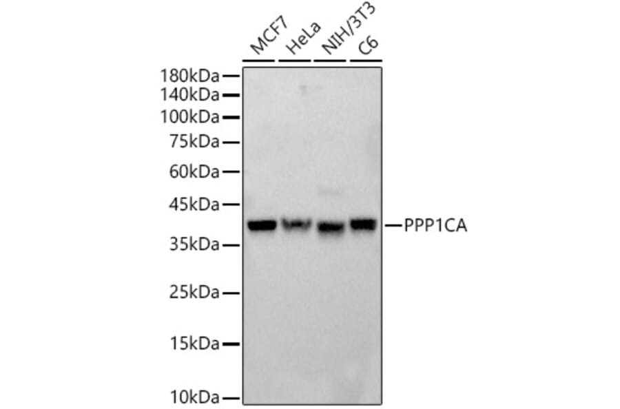 Western Blot - Anti-PPP1A/PPP1CA Antibody (A89631) - Antibodies.com