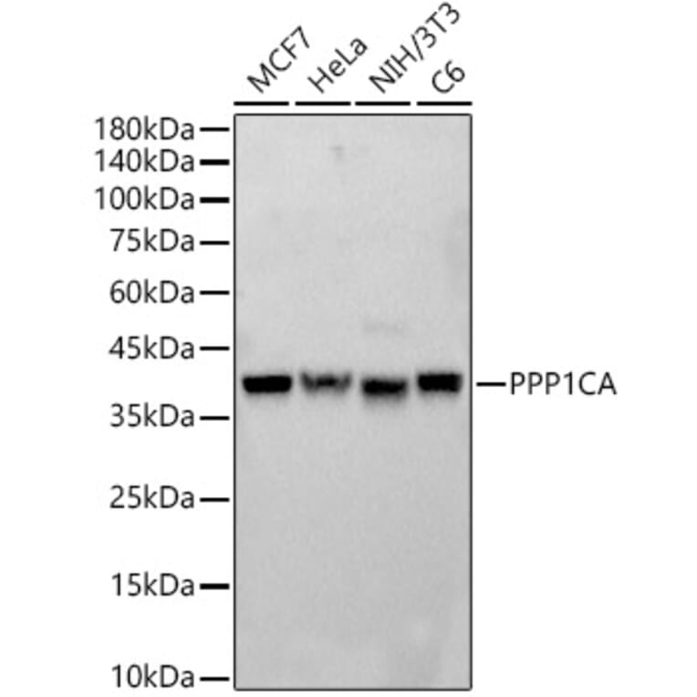 Western Blot - Anti-PPP1A/PPP1CA Antibody (A89631) - Antibodies.com