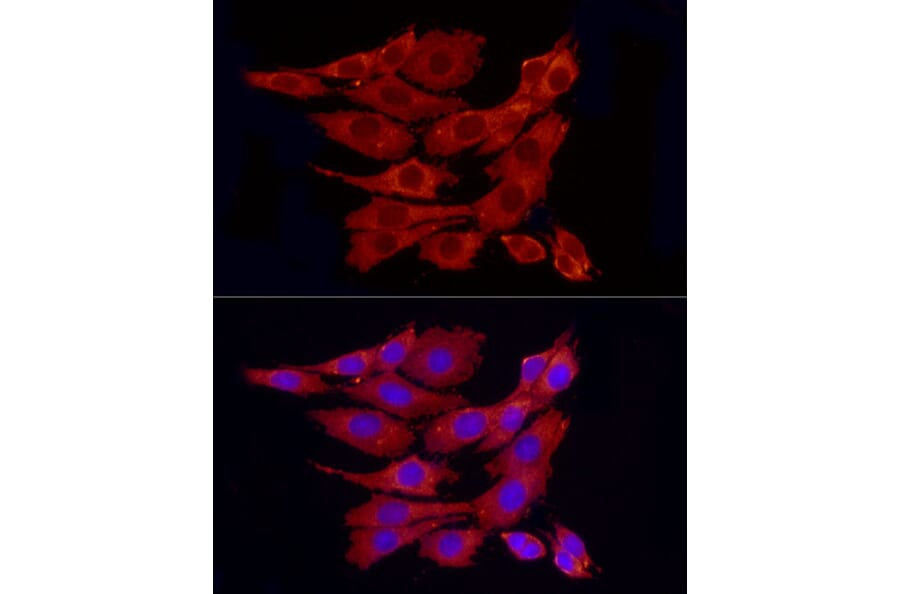 Immunofluorescence - Anti-PPP1A/PPP1CA Antibody (A89631) - Antibodies.com