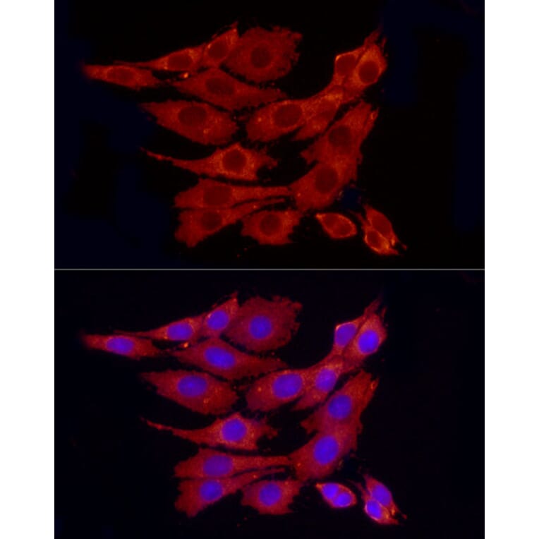 Immunofluorescence - Anti-PPP1A/PPP1CA Antibody (A89631) - Antibodies.com
