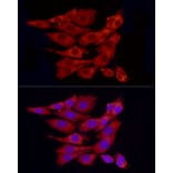Immunofluorescence - Anti-PPP1A/PPP1CA Antibody (A89631) - Antibodies.com