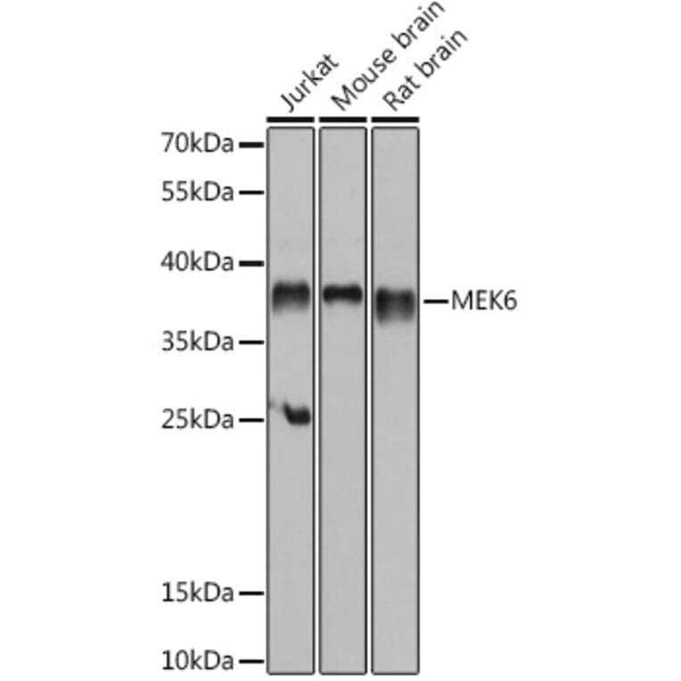 Western Blot - Anti-MKK6 Antibody (A89633) - Antibodies.com
