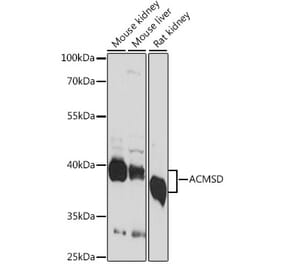 Western Blot - Anti-ACMSD Antibody (A89634) - Antibodies.com