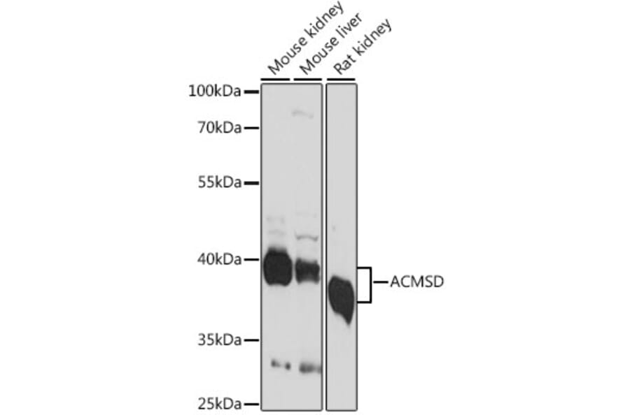 Western Blot - Anti-ACMSD Antibody (A89634) - Antibodies.com