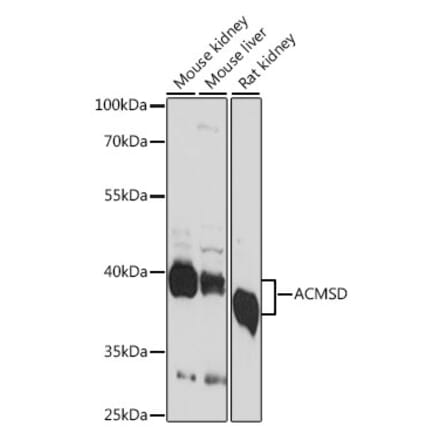 Western Blot - Anti-ACMSD Antibody (A89634) - Antibodies.com