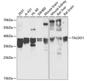 Western Blot - Anti-Transaldolase 1 Antibody (A89635) - Antibodies.com