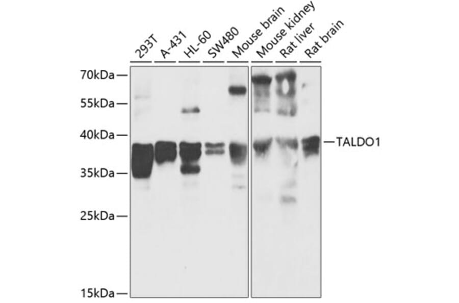 Western Blot - Anti-Transaldolase 1 Antibody (A89635) - Antibodies.com