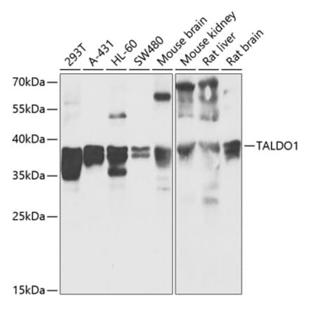 Western Blot - Anti-Transaldolase 1 Antibody (A89635) - Antibodies.com