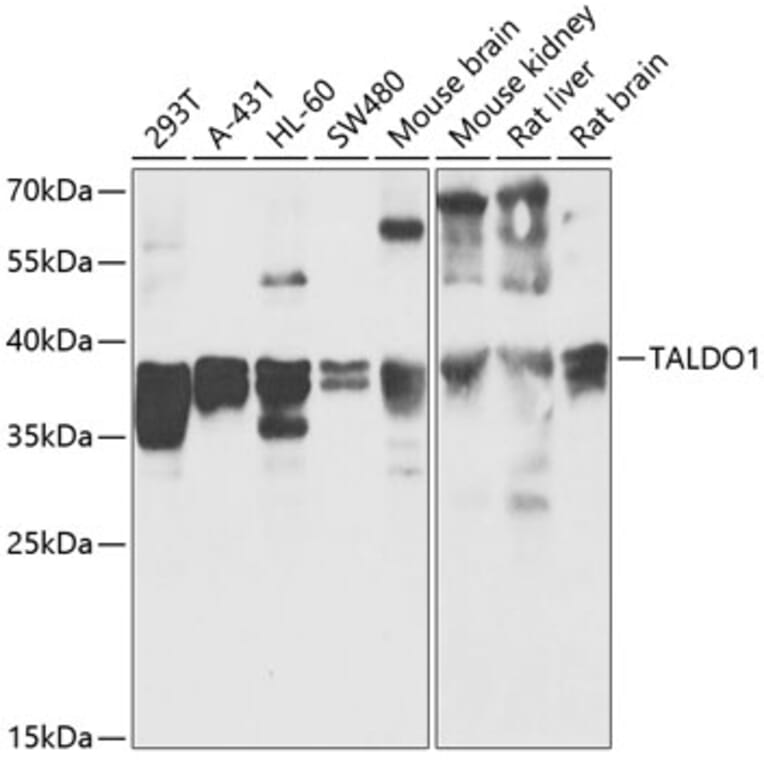 Western Blot - Anti-Transaldolase 1 Antibody (A89635) - Antibodies.com