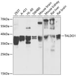 Western Blot - Anti-Transaldolase 1 Antibody (A89635) - Antibodies.com