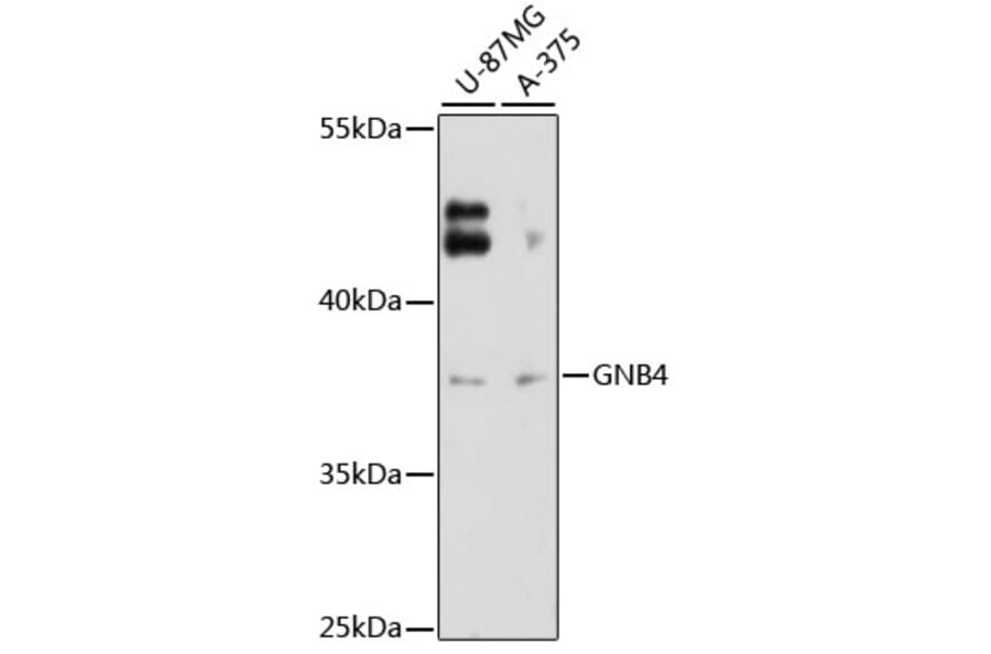 Western Blot - Anti-GNB4 Antibody (A12731) - Antibodies.com