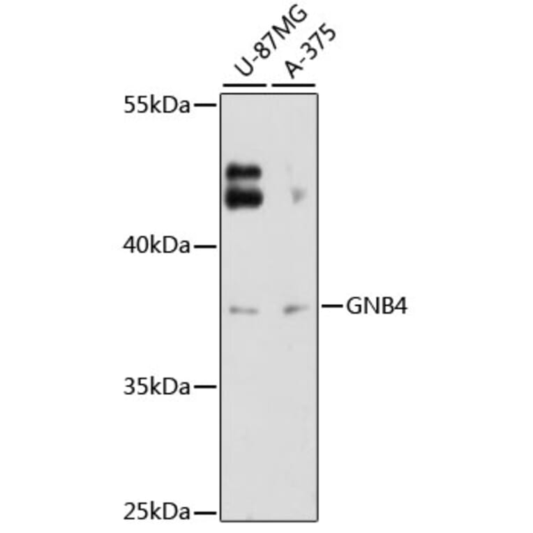 Western Blot - Anti-GNB4 Antibody (A12731) - Antibodies.com