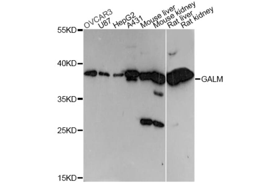 Western Blot - Anti-GALM Antibody (A14362) - Antibodies.com