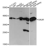 Western Blot - Anti-GALM Antibody (A14362) - Antibodies.com