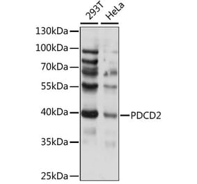 Western Blot - Anti-PDCD2 Antibody (A89638) - Antibodies.com