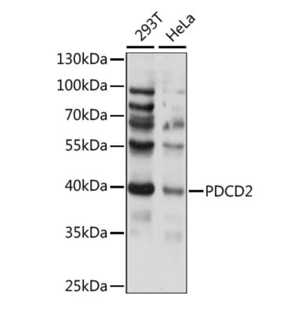 Western Blot - Anti-PDCD2 Antibody (A89638) - Antibodies.com