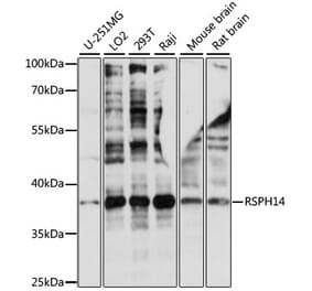 Western Blot - Anti-RSPH14 Antibody (A89639) - Antibodies.com