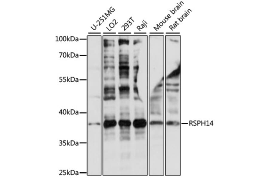 Western Blot - Anti-RSPH14 Antibody (A89639) - Antibodies.com