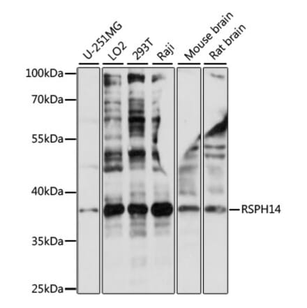 Western Blot - Anti-RSPH14 Antibody (A89639) - Antibodies.com