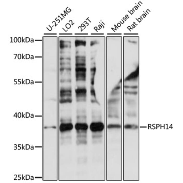 Western Blot - Anti-RSPH14 Antibody (A89639) - Antibodies.com