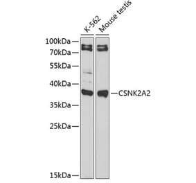 Western Blot - Anti-CSNK2A2 Antibody (A89640) - Antibodies.com