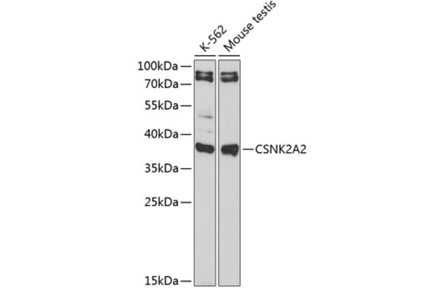 Western Blot - Anti-CSNK2A2 Antibody (A89640) - Antibodies.com