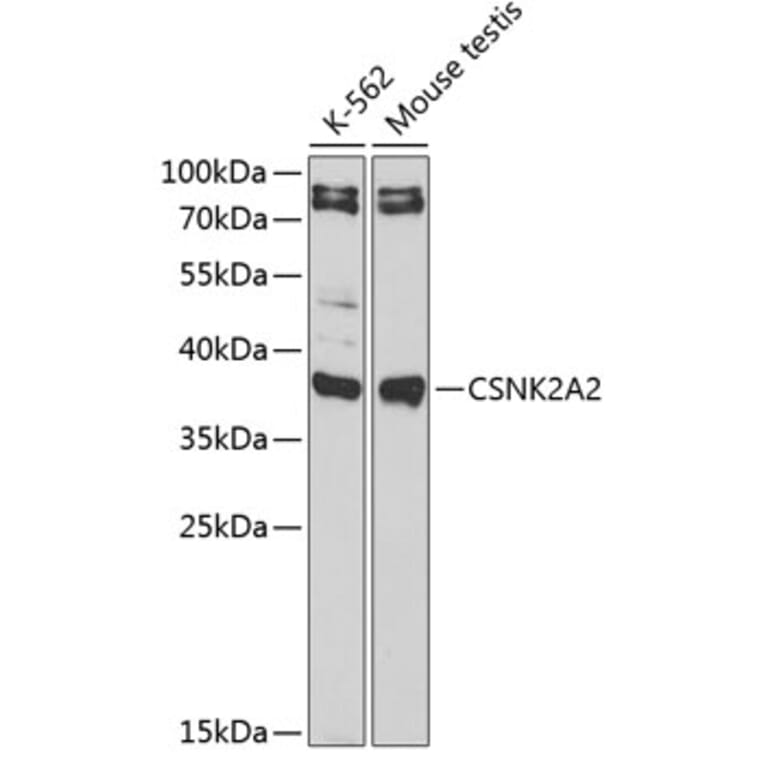 Western Blot - Anti-CSNK2A2 Antibody (A89640) - Antibodies.com