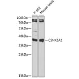 Western Blot - Anti-CSNK2A2 Antibody (A89640) - Antibodies.com