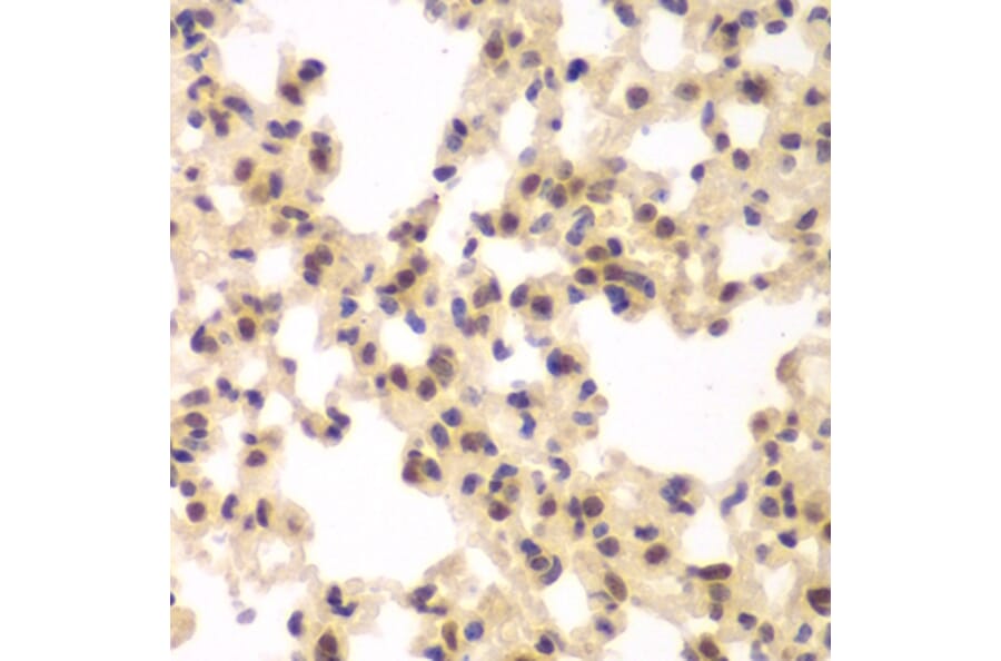 Immunohistochemistry - Anti-CSNK2A2 Antibody (A89640) - Antibodies.com