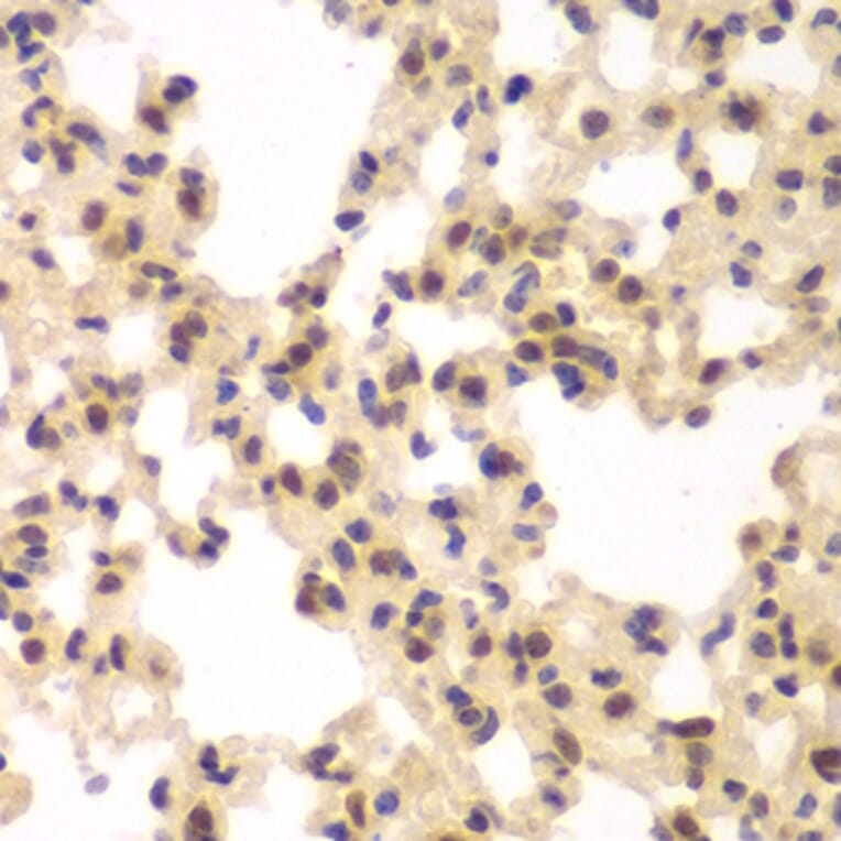 Immunohistochemistry - Anti-CSNK2A2 Antibody (A89640) - Antibodies.com