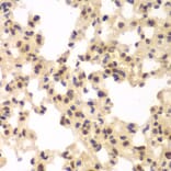 Immunohistochemistry - Anti-CSNK2A2 Antibody (A89640) - Antibodies.com