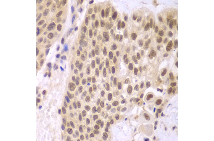 Immunohistochemistry - Anti-CSNK2A2 Antibody (A89640) - Antibodies.com