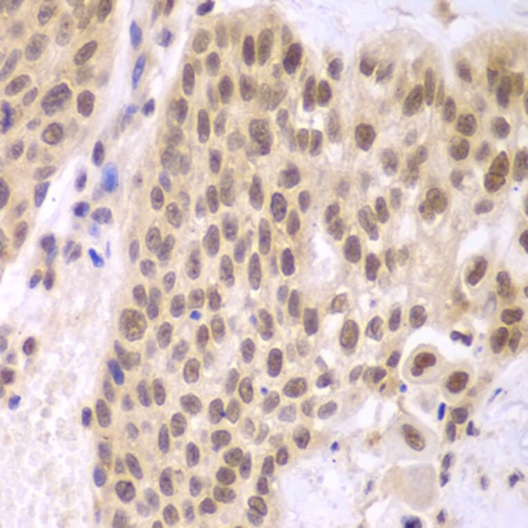 Immunohistochemistry - Anti-CSNK2A2 Antibody (A89640) - Antibodies.com