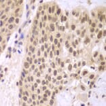 Immunohistochemistry - Anti-CSNK2A2 Antibody (A89640) - Antibodies.com