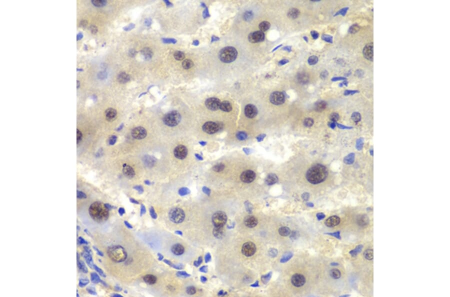 Immunohistochemistry - Anti-CSNK2A2 Antibody (A89640) - Antibodies.com