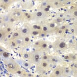 Immunohistochemistry - Anti-CSNK2A2 Antibody (A89640) - Antibodies.com