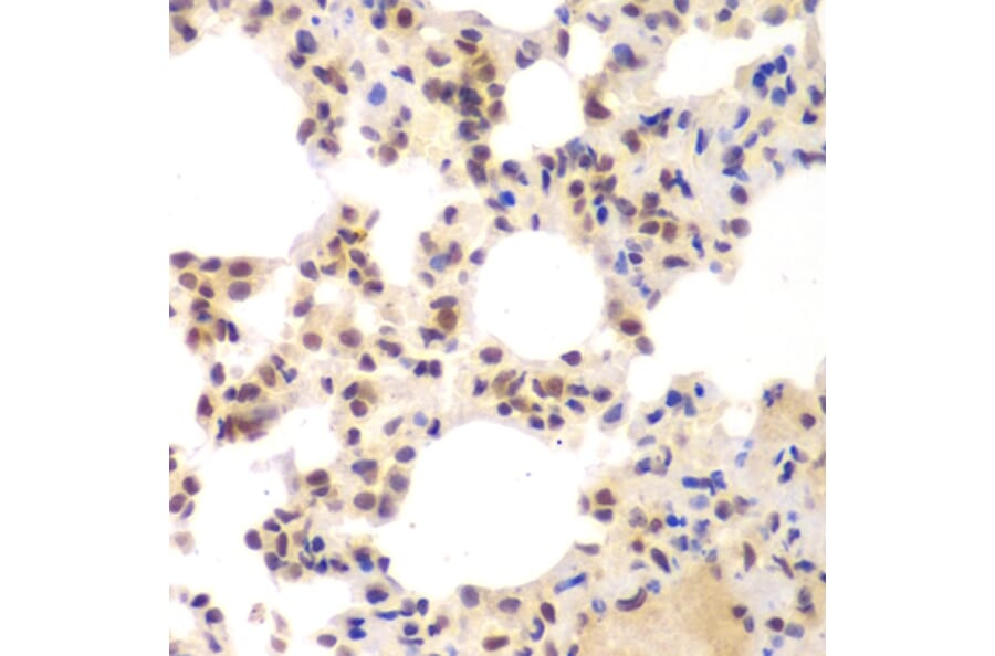 Immunohistochemistry - Anti-CSNK2A2 Antibody (A89640) - Antibodies.com