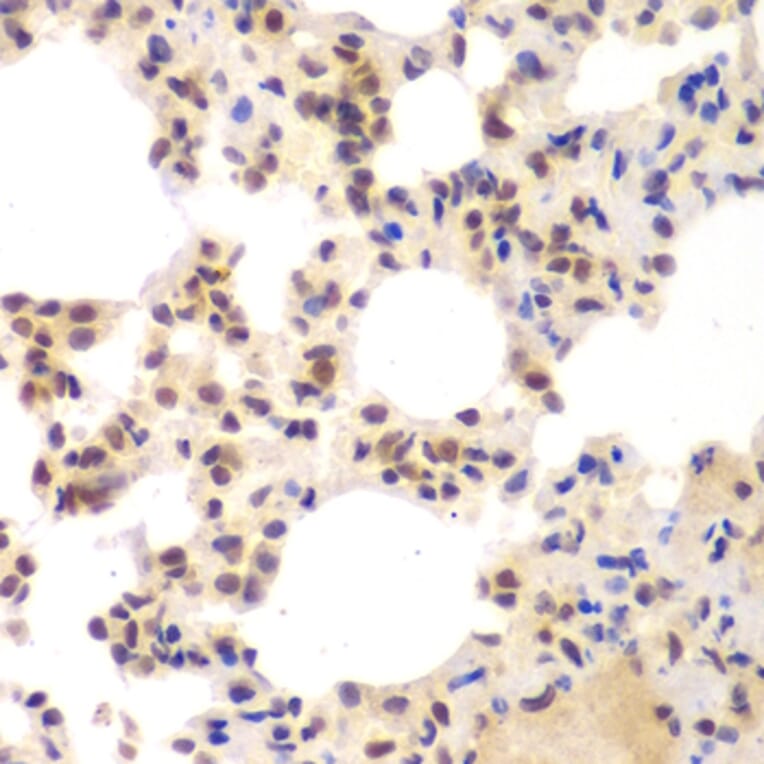 Immunohistochemistry - Anti-CSNK2A2 Antibody (A89640) - Antibodies.com