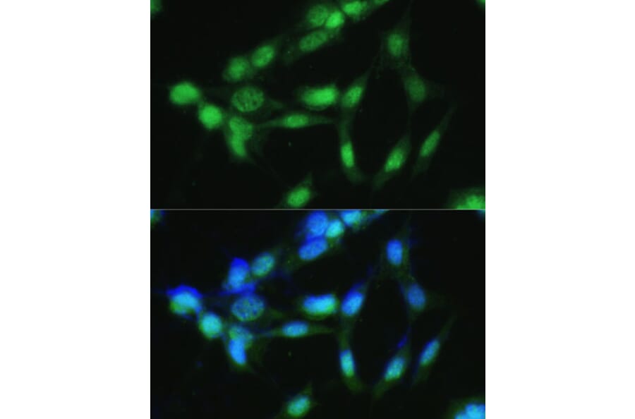 Immunofluorescence - Anti-CSNK2A2 Antibody (A89640) - Antibodies.com