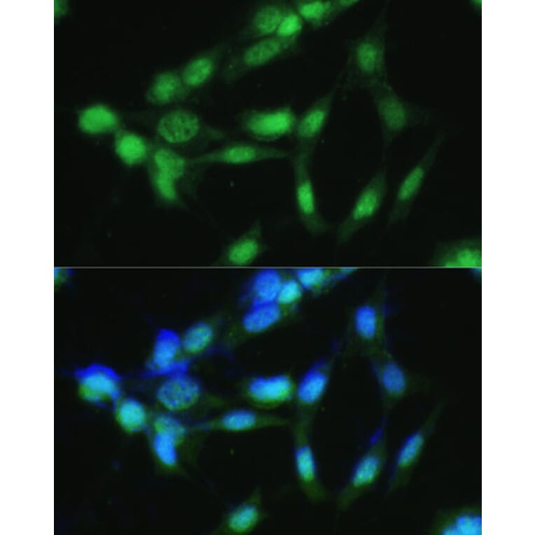 Immunofluorescence - Anti-CSNK2A2 Antibody (A89640) - Antibodies.com
