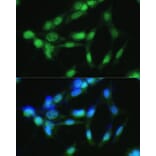 Immunofluorescence - Anti-CSNK2A2 Antibody (A89640) - Antibodies.com