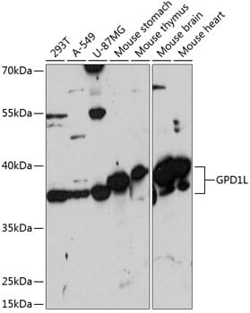 Western blot analysis of extracts of various cell lines, using Anti-GPD1L Antibody (A14392) at 1:3000 dilution.
Secondary antibody: Goat Anti-Rabbit IgG (H+L) (HRP) (AS014) at 1:10,000 dilution.
Lysates / proteins: 25µg per lane.
Blocking buffer: 3% non-fat dry milk in TBST.
Detection: ECL Basic Kit (RM00020).
Exposure time: 1s.