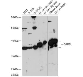 Western Blot - Anti-GPD1L Antibody (A89641) - Antibodies.com