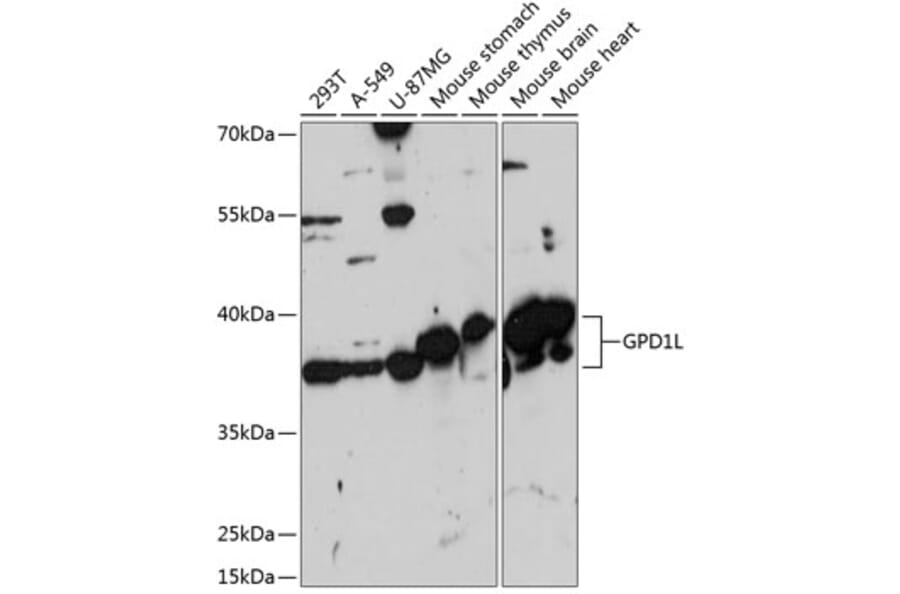 Western Blot - Anti-GPD1L Antibody (A89641) - Antibodies.com